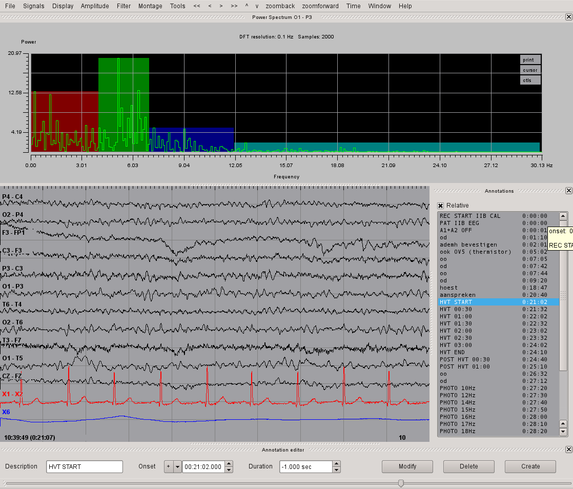 Eeg Ppt Download For Mac